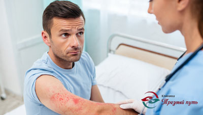 МУжчина с покрасневшей сыпью сидит на кушетке, рядом стоит врач